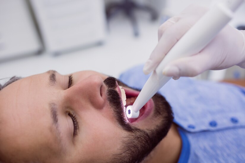 FULL MOUTH REHABILITATION