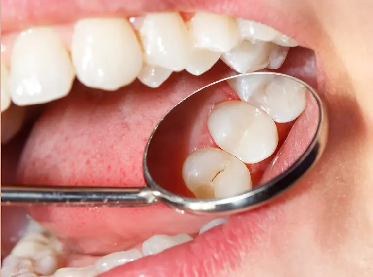 ORTHODONTICS