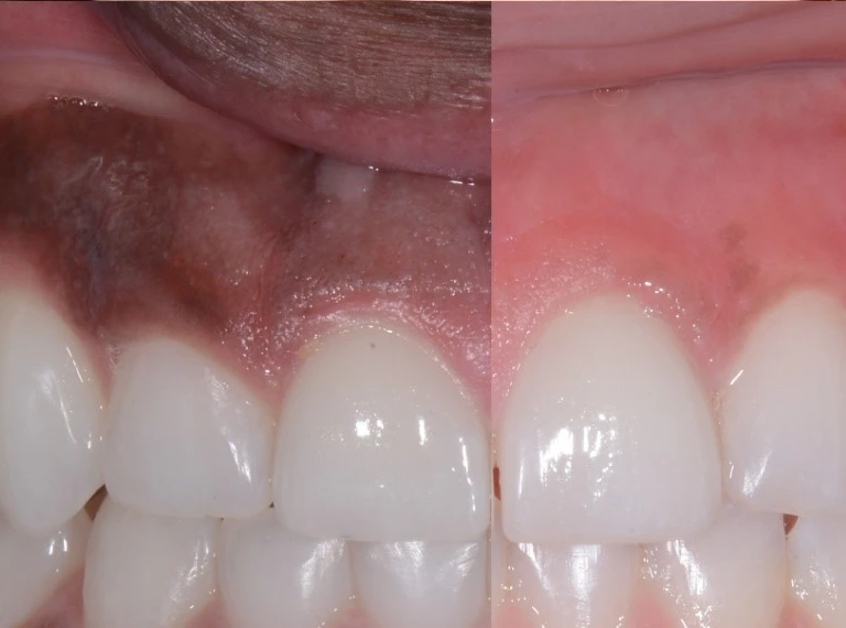 PERIODONTAL